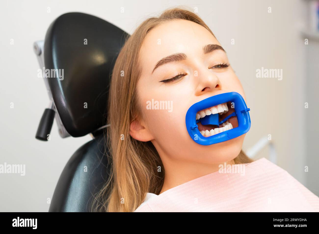 Ritratto di una donna che indossa un divaricatore per bocca dentale Foto  stock - Alamy