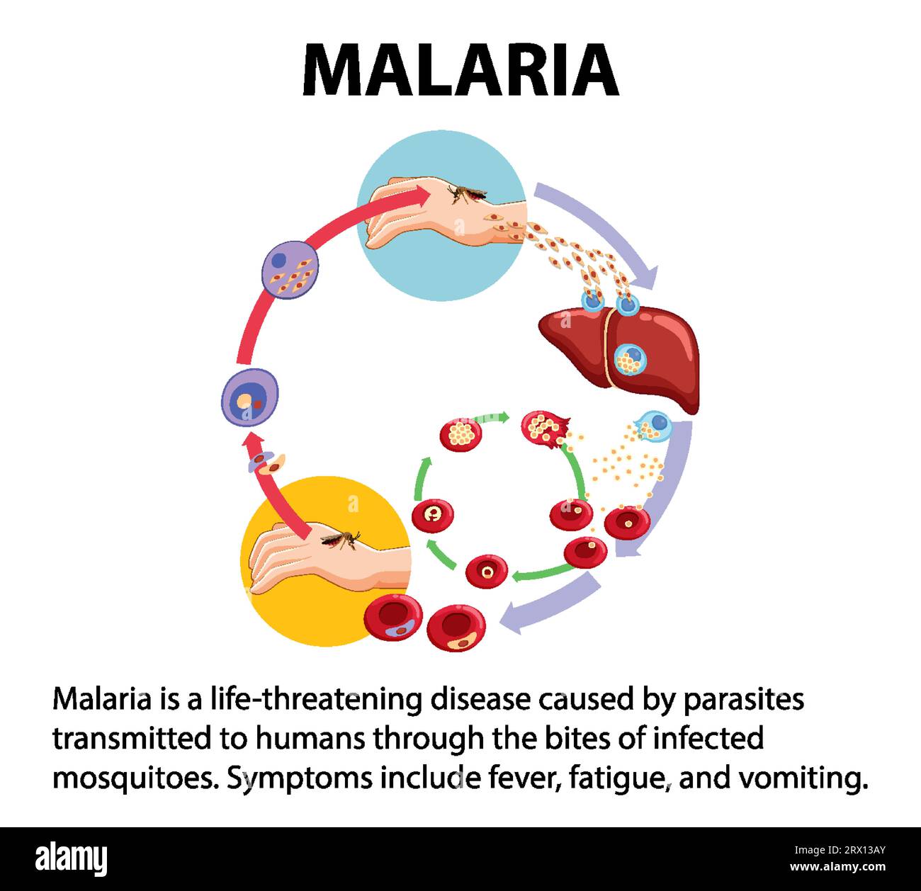 Infografica illustrata che illustra le fasi della trasmissione dei parassiti della malaria Illustrazione Vettoriale