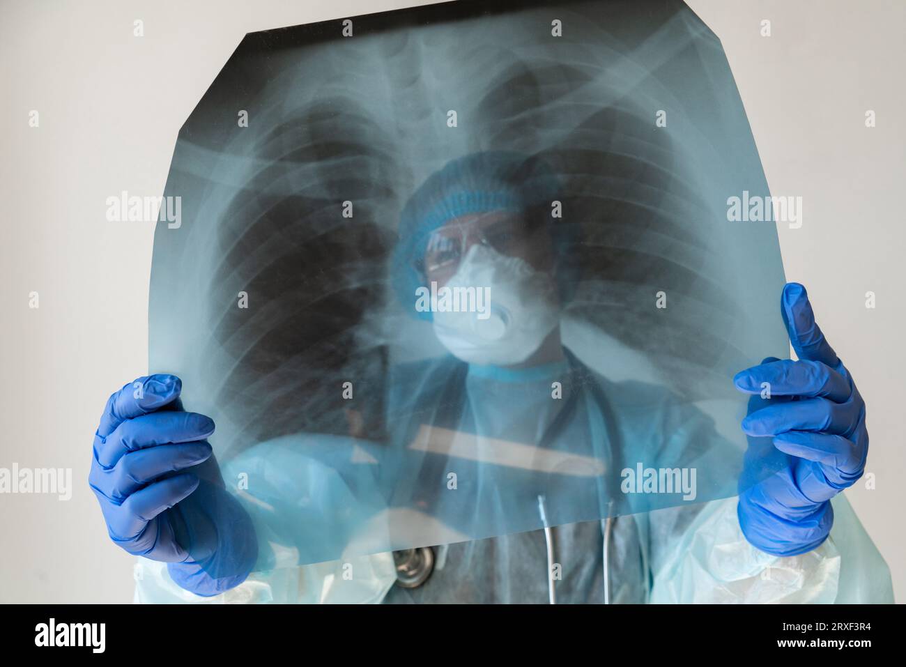 Medico donna che guarda la radiografia dei polmoni. Foto Stock
