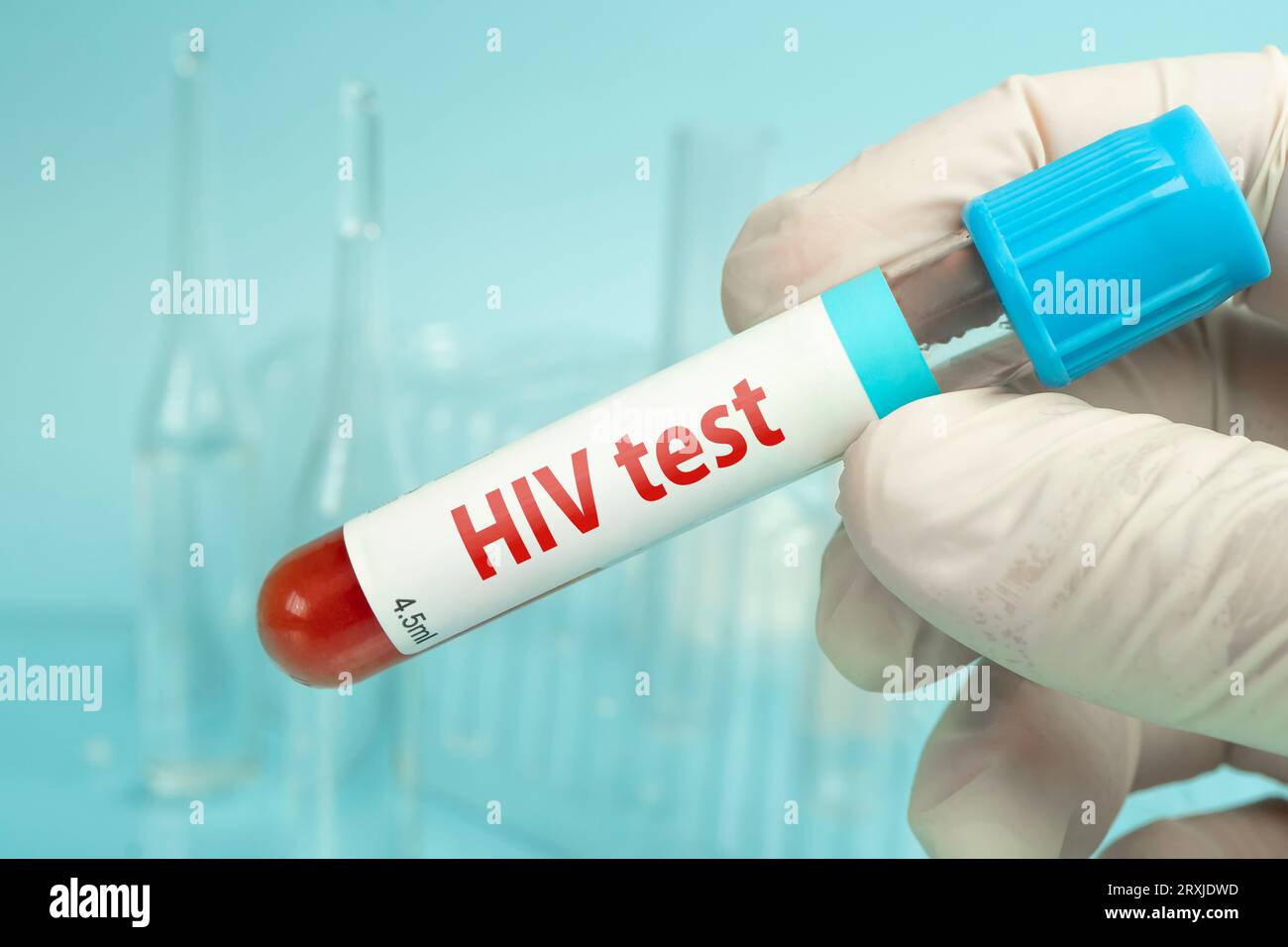 Mano che tiene un campione di sangue per il test HIV su uno sfondo di laboratorio blu. Foto Stock