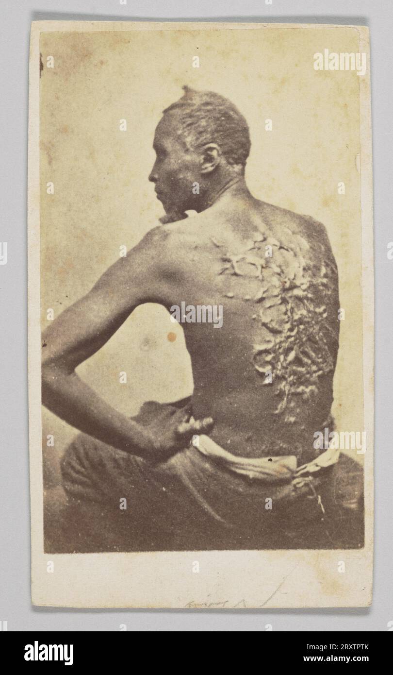 Gordon sotto ispezione medica 1863 Foto Stock