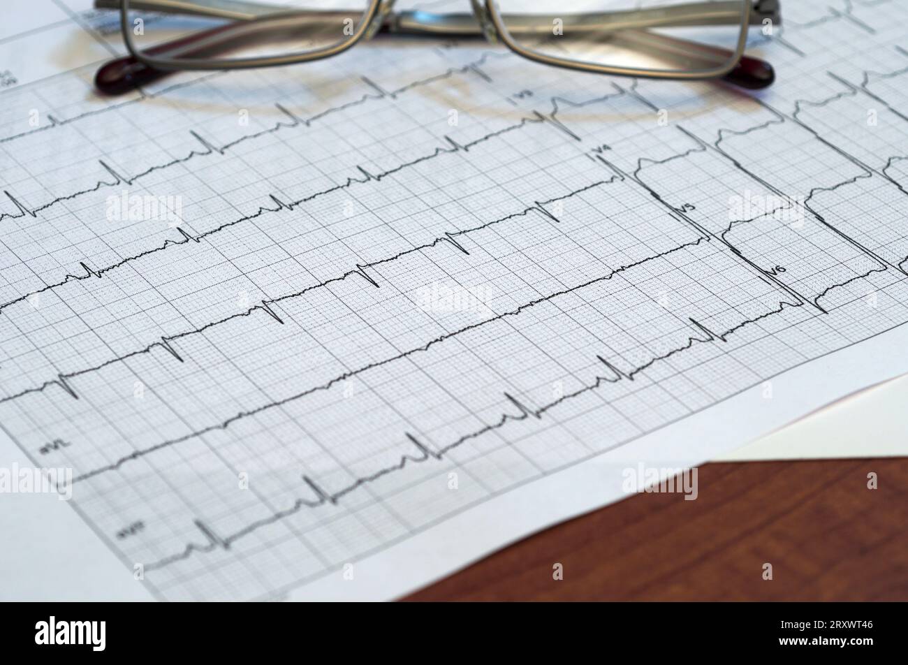 Occhiali su elettrocardiogramma (ECG) grafico di heartbeat Foto Stock