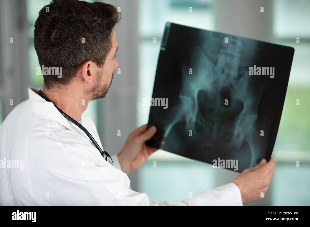 un radiologo esamina una radiografia Foto Stock