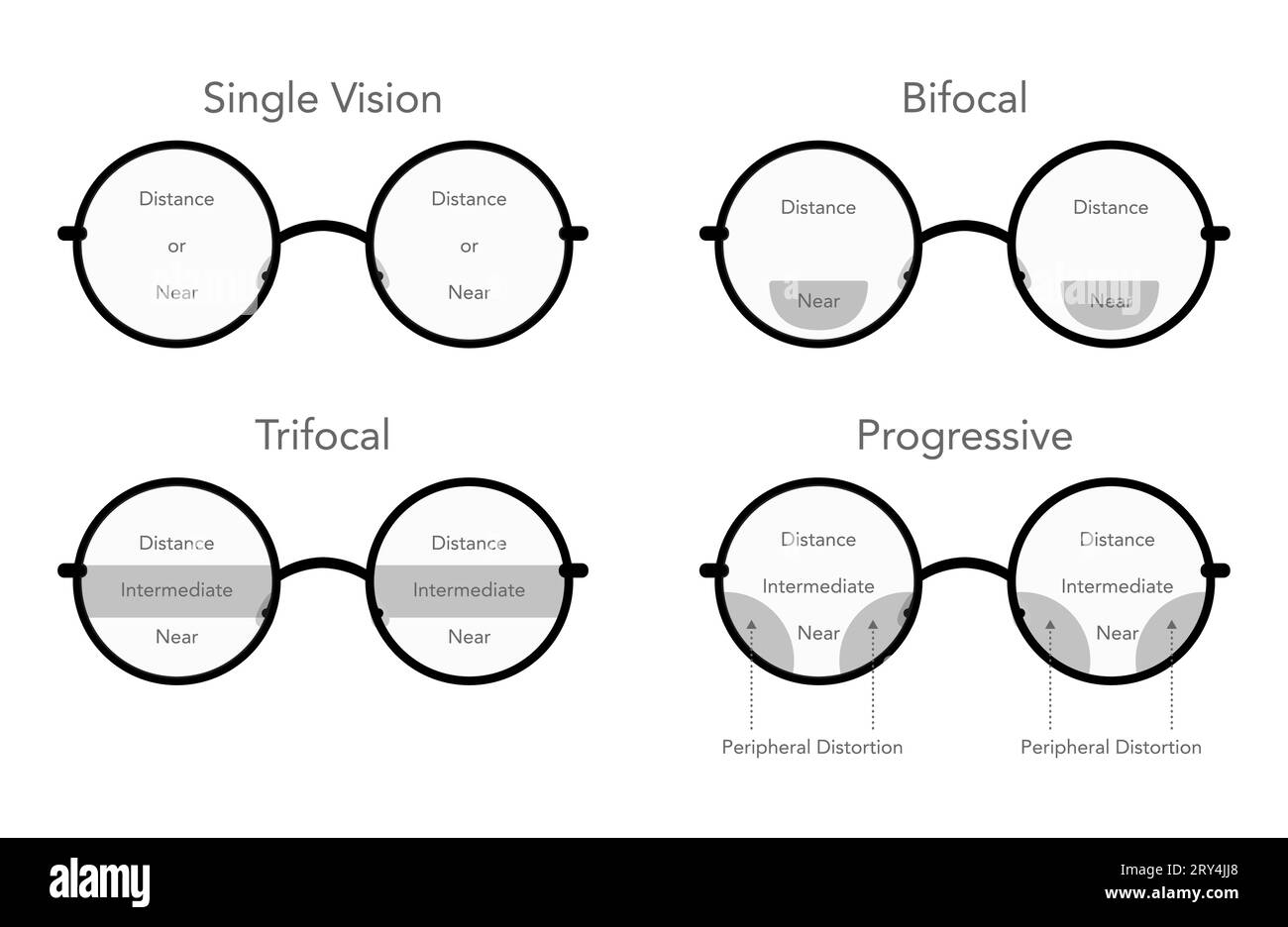 Set di zone di visione in lenti progressive campi di vista cornice oculare occhiali rotondi diagramma moda accessorio illustrazione medica. Occhiali da vista frontale con bordo piatto e lenti Illustrazione Vettoriale