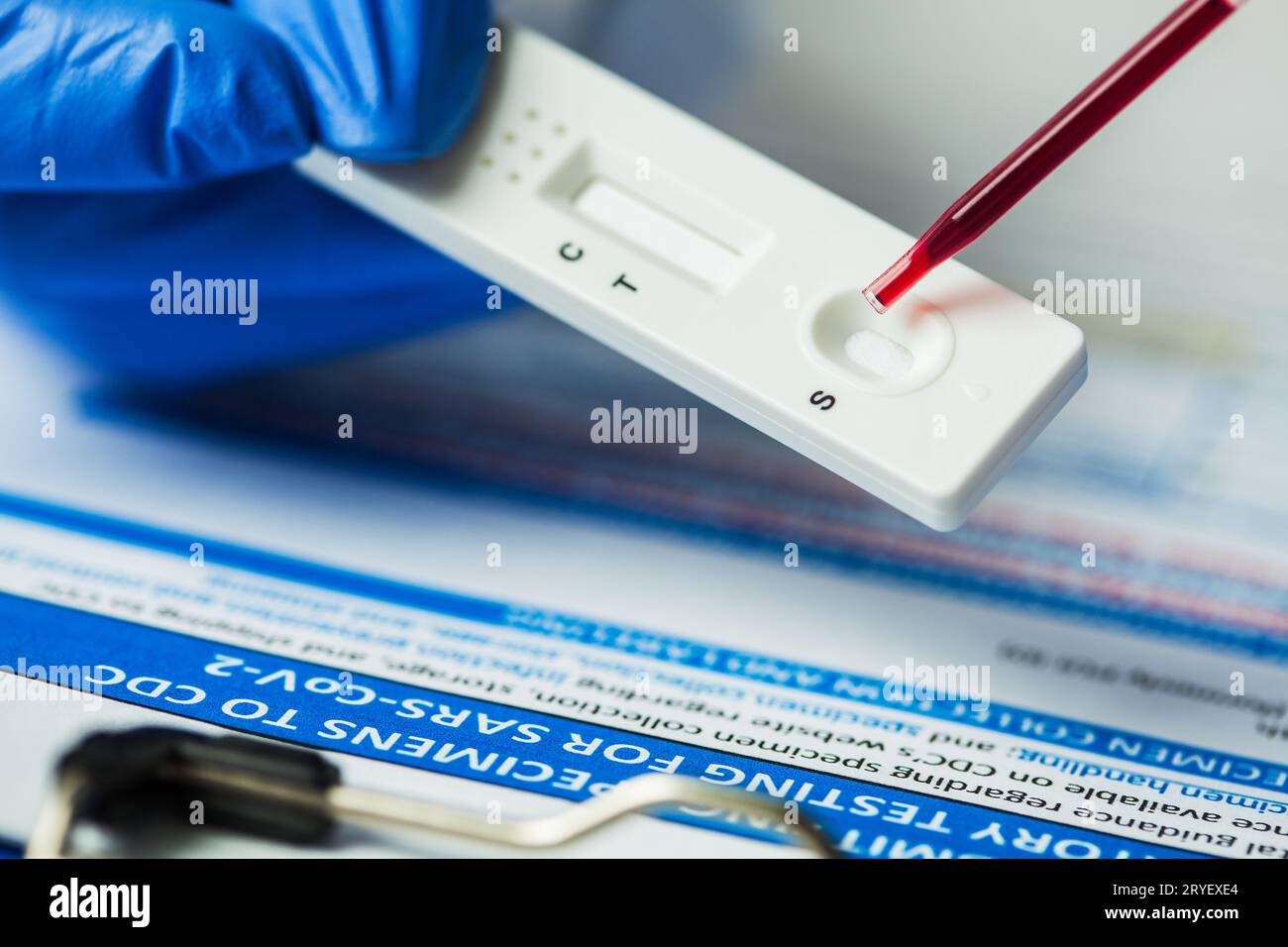 Tecnico medico di laboratorio che utilizza una pipetta per sottoporre il campione di sangue a un test diagnostico rapido Foto Stock