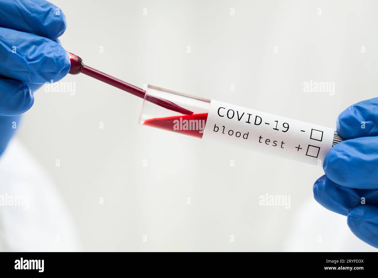 Procedura di analisi del sangue in laboratorio sierologico per COVID-19 Foto Stock