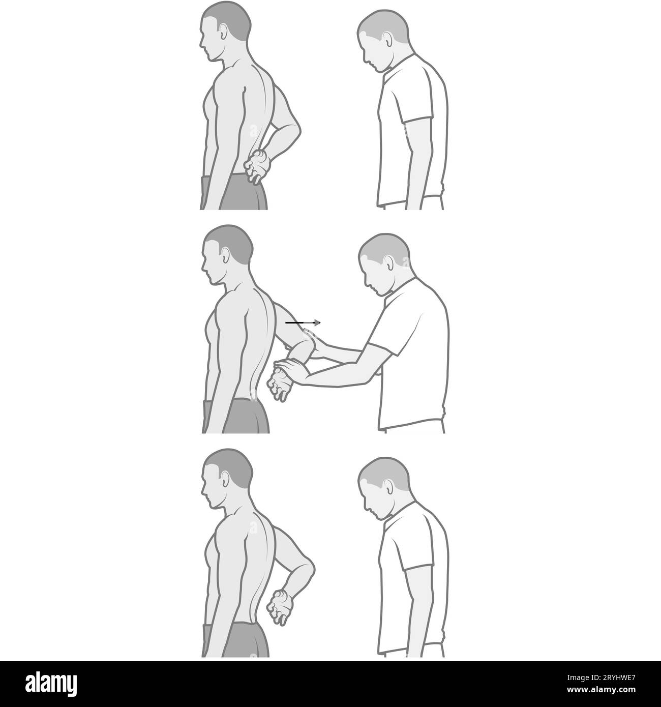 Il test di sollevamento della spalla, noto anche come "segno di sollevamento" o "prova di pressione del ventre", è una tecnica di esame clinico utilizzata dalla professione sanitaria Foto Stock
