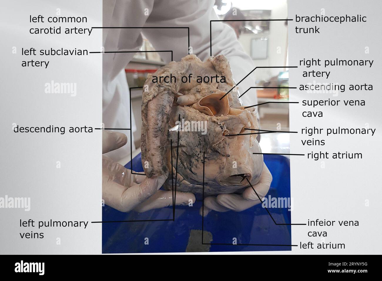 anatomia della vista posteriore del cuore con grandi vasi collegati Foto Stock