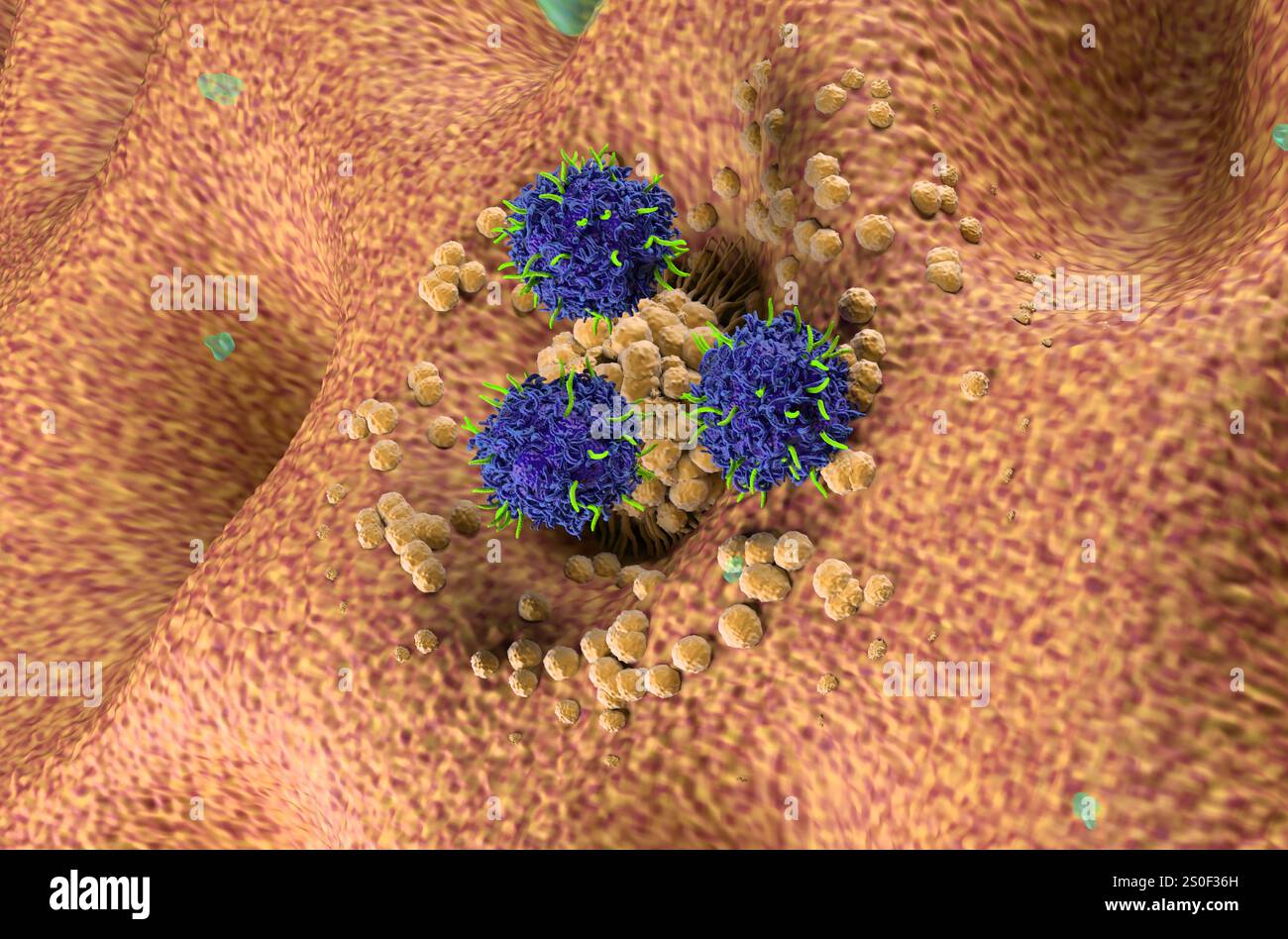 Terapia con cellule T di CAR nel cancro dello stomaco (gastrico) - Vista isometrica illustrazione 3d. Foto Stock