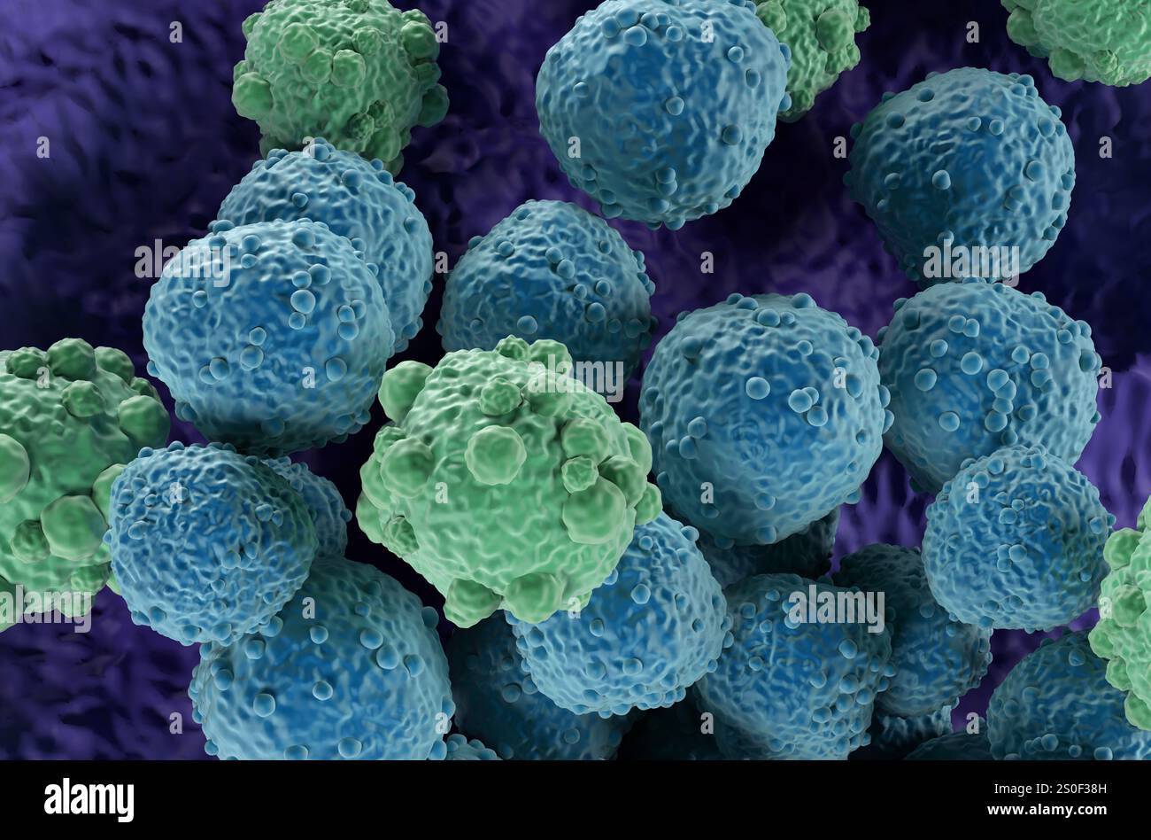 Linfoma cellulare - Vista isometrica illustrazione 3d. Foto Stock