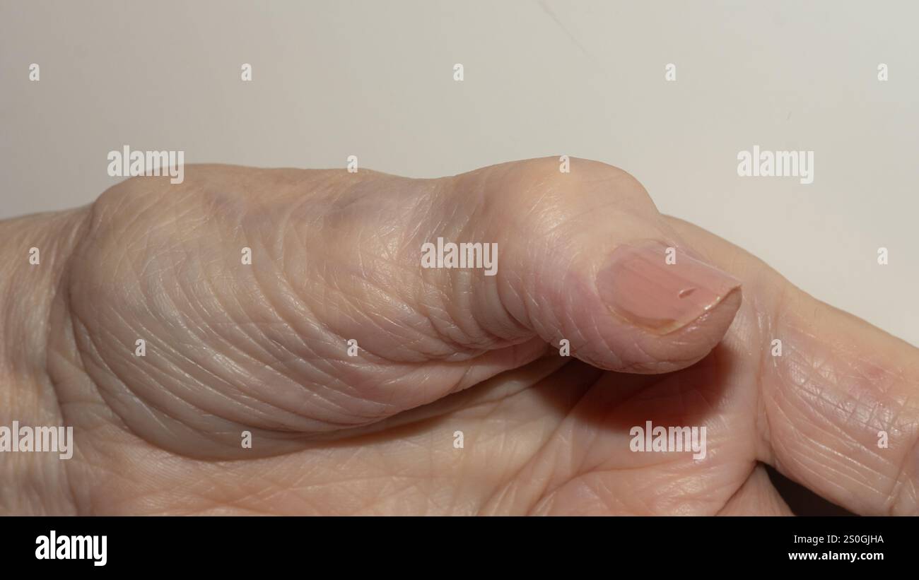 Primo piano intimo e dettagliato della mano di una donna anziana, che mostra la consistenza naturale e i segni dell'invecchiamento con una chiara attenzione alla pelle e alle dita Foto Stock