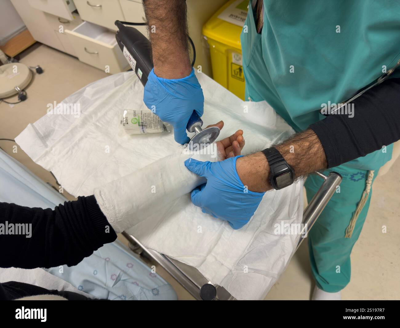 Un chirurgo ortopedico taglia la mano fusa di un paziente in un ospedale di Gerusalemme Israele Foto Stock