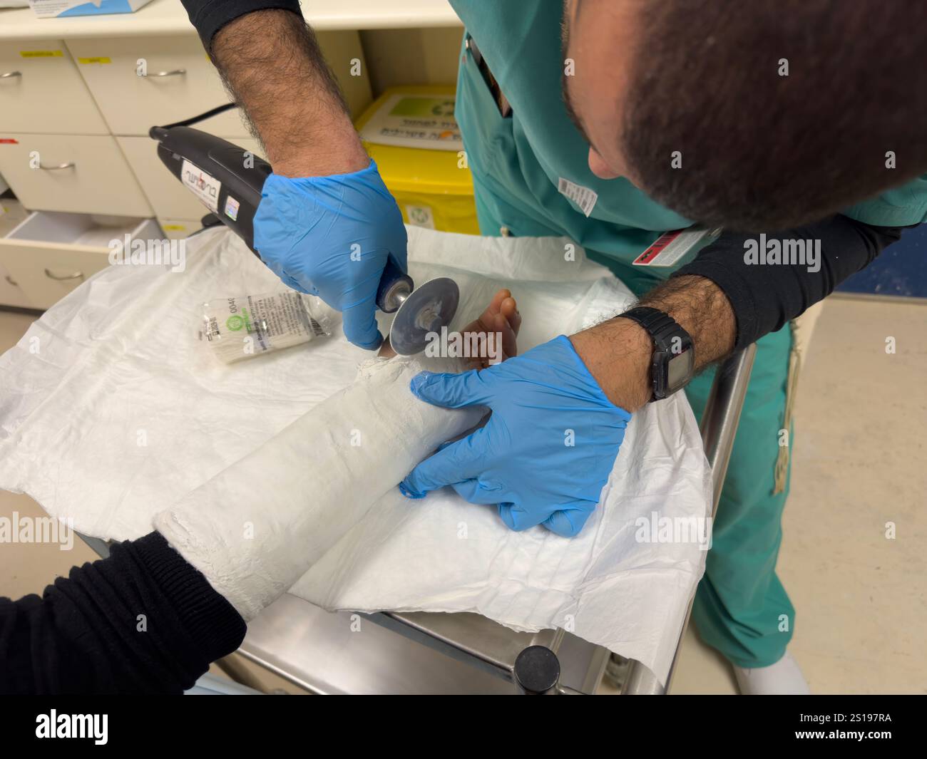 Un chirurgo ortopedico taglia la mano fusa di un paziente in un ospedale di Gerusalemme Israele Foto Stock