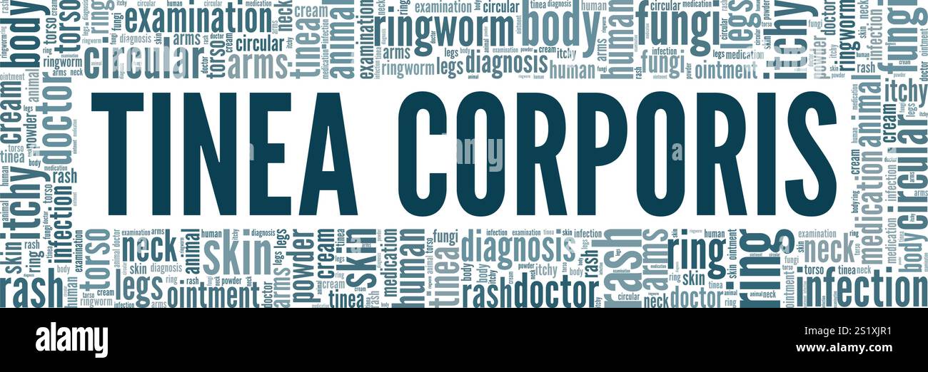 Tinea Corporis - progettazione concettuale di nuvole di parole ringworm isolata su sfondo bianco. Illustrazione Vettoriale