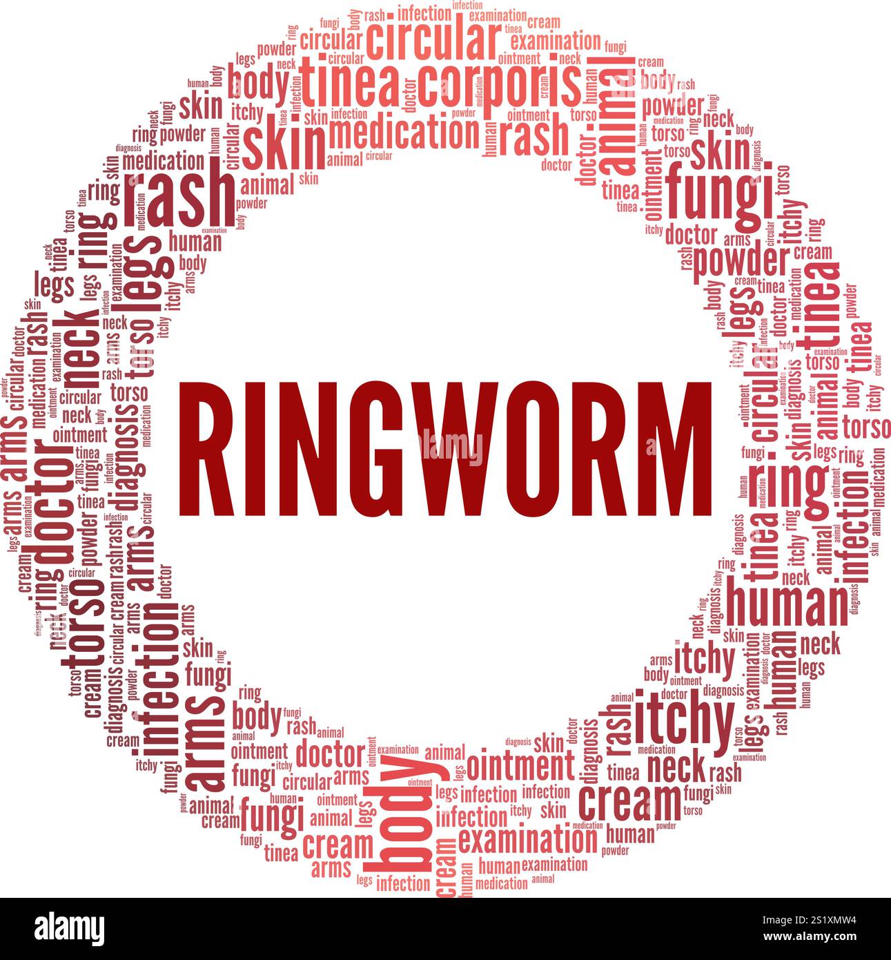 Tinea Corporis - progettazione concettuale di nuvole di parole ringworm isolata su sfondo bianco. Illustrazione Vettoriale