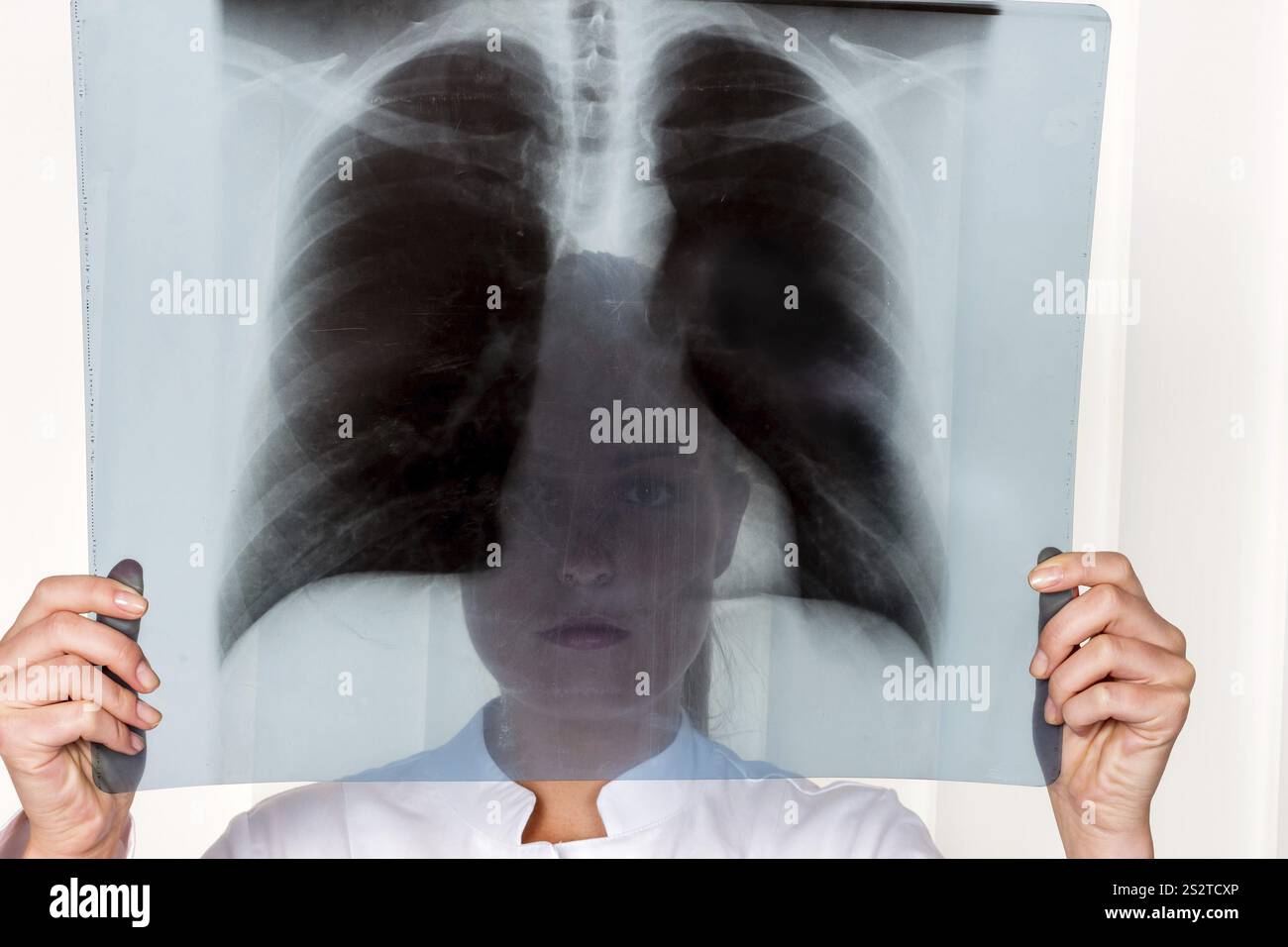 Infermiere o medico indossato indumenti chirurgici di fronte a un intervento chirurgico. Foto simbolica per il lavoro in ospedale Austria Foto Stock