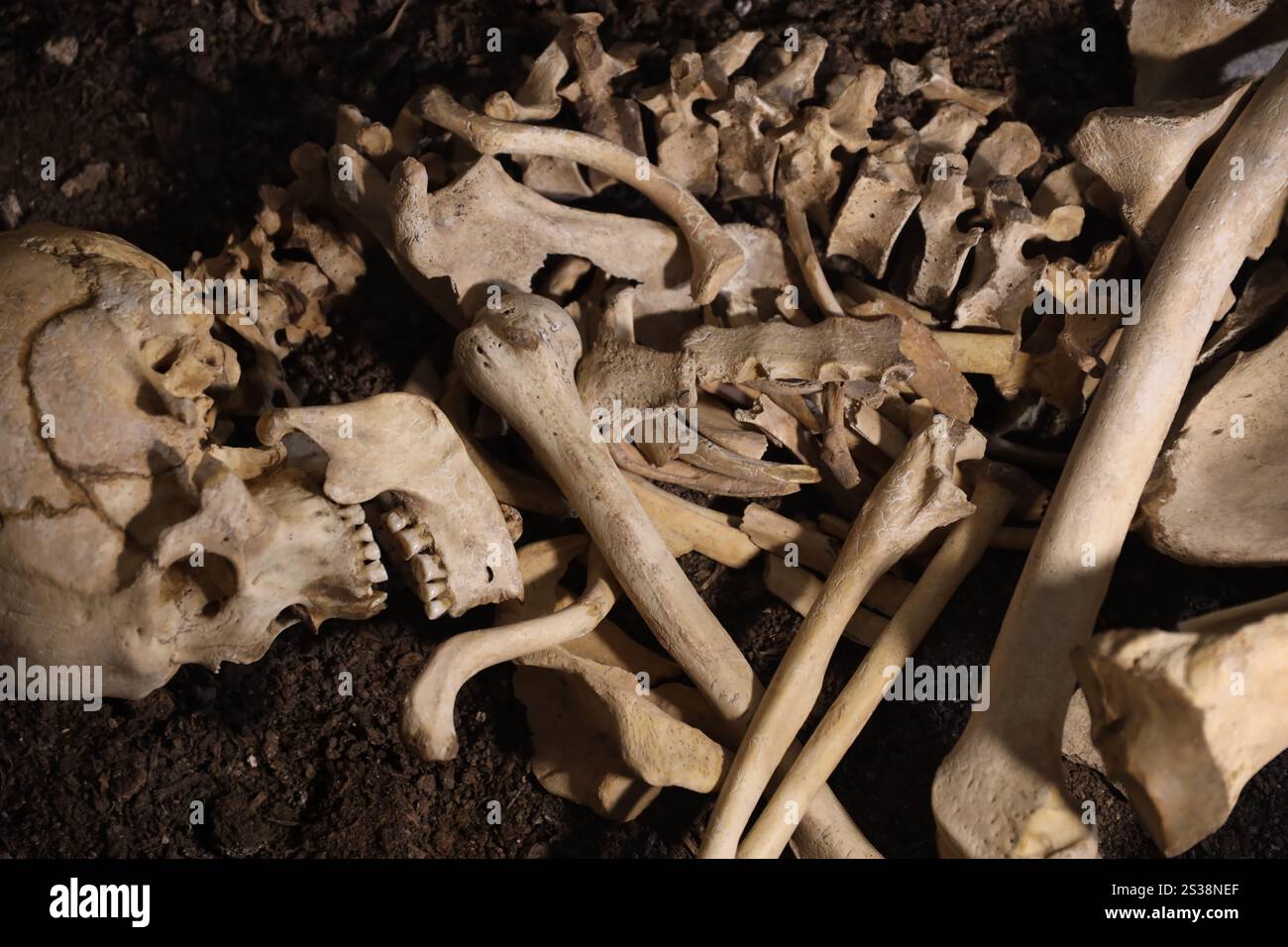 Cranio e ossa scavati dalla fossa nel spaventoso cimitero dei prigionieri dopo le torture. Cranio e ossa scavate dalla fossa nel cimitero spaventoso di Foto Stock