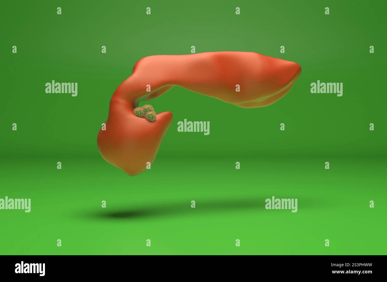 Cancro del pancreas - Vista isometrica illustrazione 3d. Foto Stock
