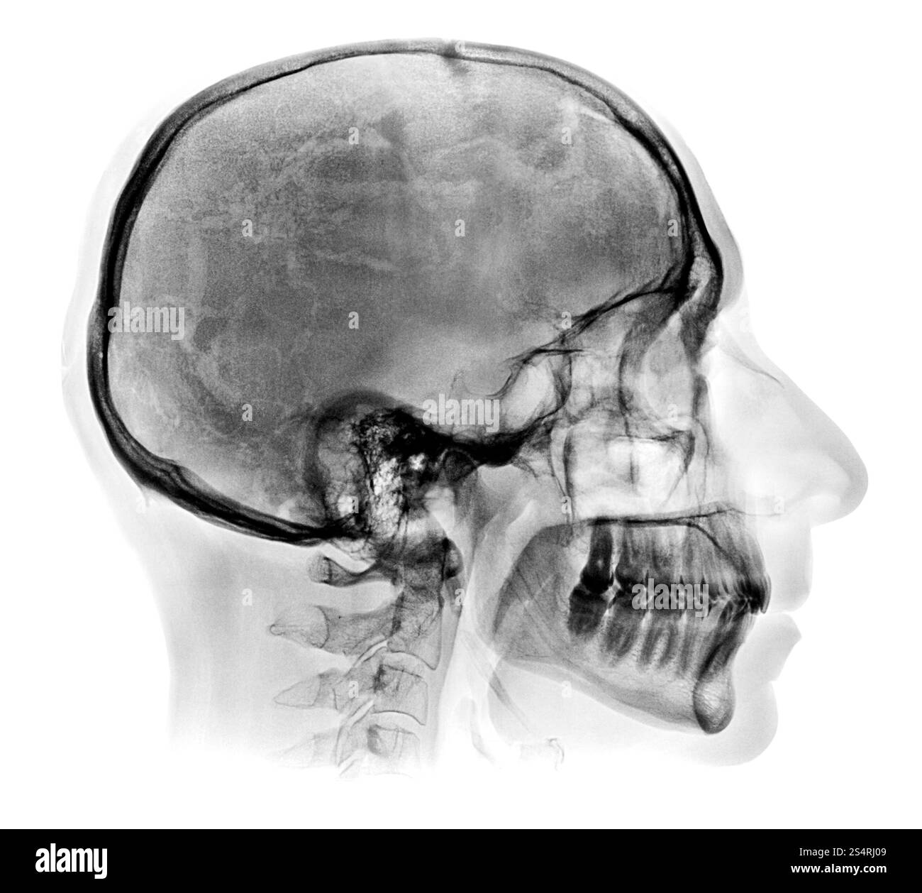 Immagine radiografica del cranio umano isolata su bianco. Immagine radiografica dettagliata del cranio umano Foto Stock