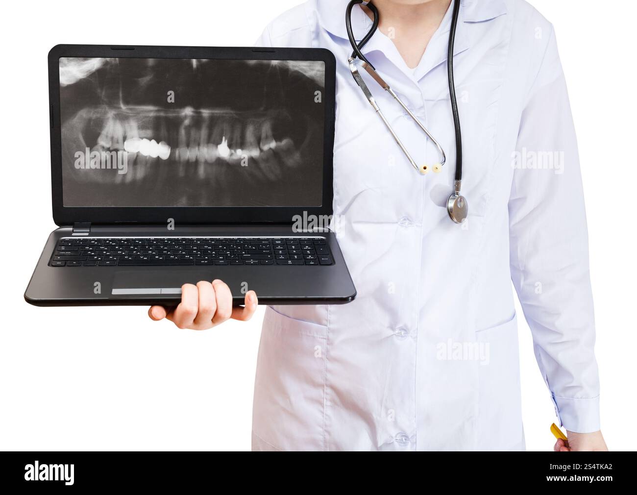 L'infermiera detiene il computer portatile con raggi X foto di denti umani sullo schermo isolato su sfondo bianco Foto Stock