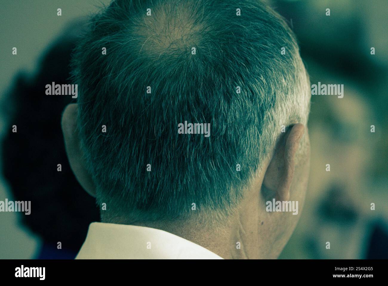 Punto calvo sul retro della testa dell'uomo. Testa maschile Baldy con primo piano di capelli diradanti Foto Stock