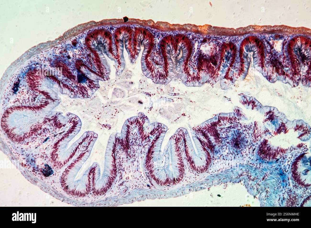 Tessuto intestino crasso al microscopio 100x Foto Stock