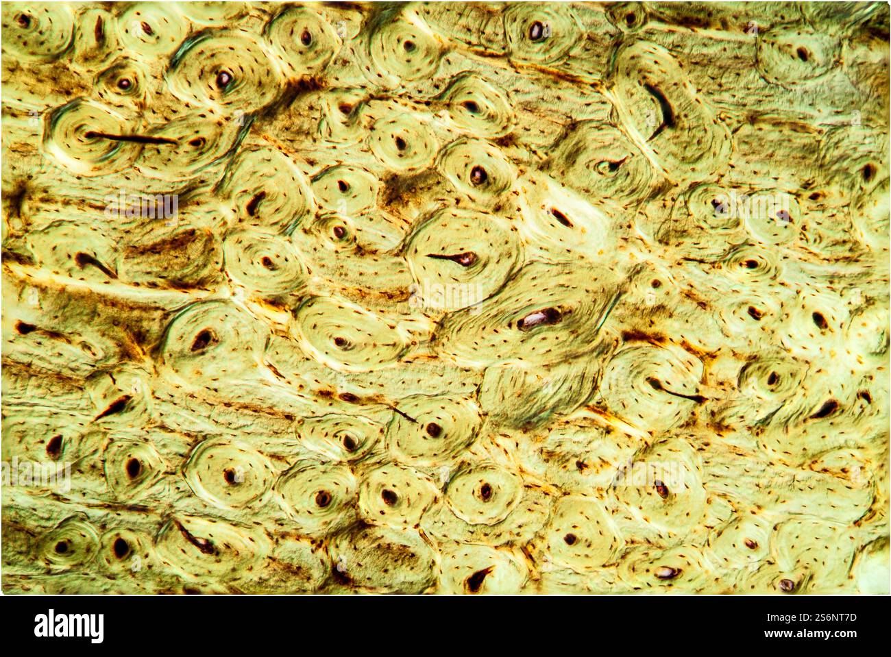 Sezione trasversale ossea 100x Foto Stock