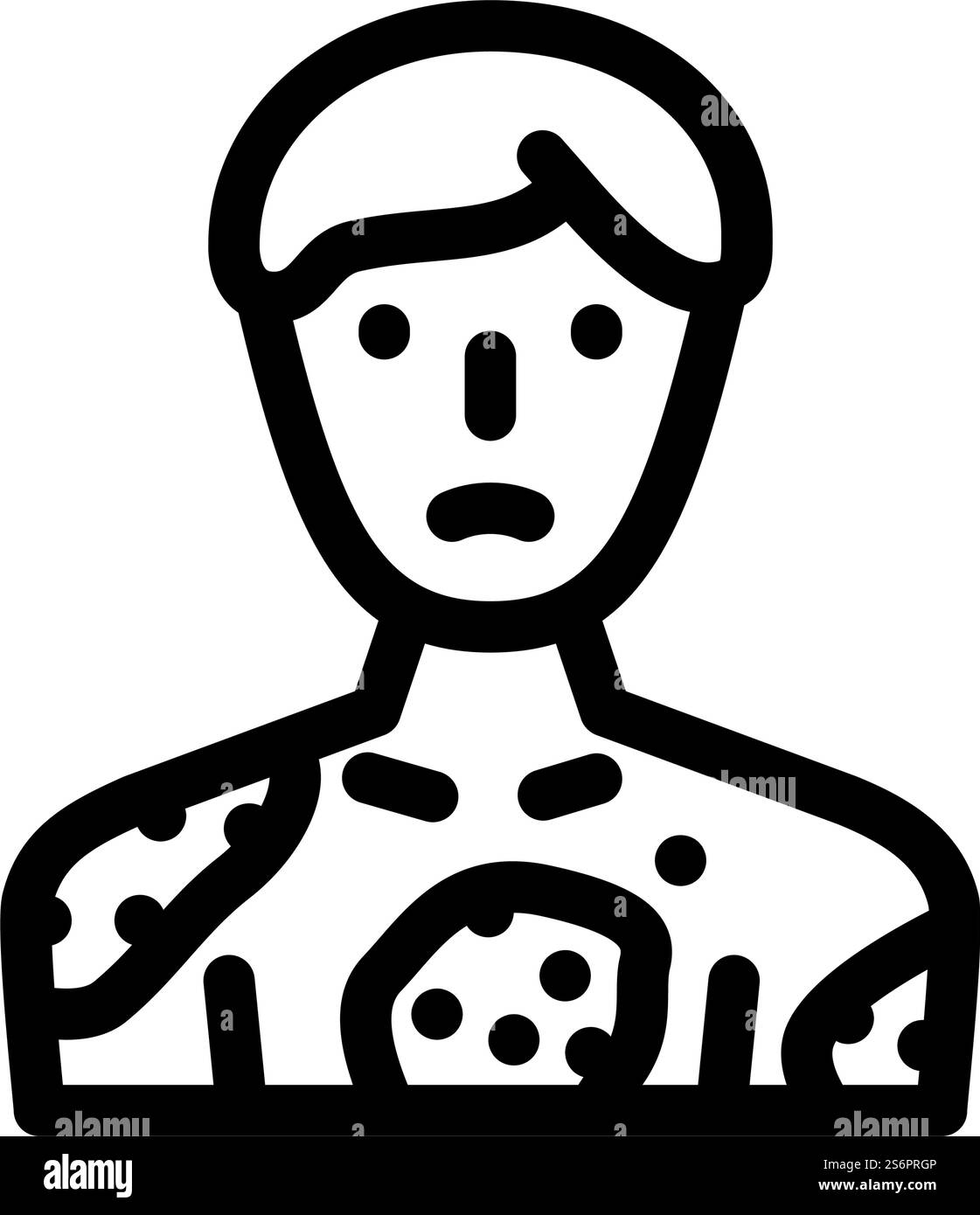 psoriasi malattia cutanea linea icona vettore. segno di malattia della pelle della psoriasi. illustrazione nera del simbolo del contorno isolato. illustrazione vettoriale dell'icona della linea di malattia della pelle della psoriasi Illustrazione Vettoriale psoriasi malattia cutanea linea icona vettore. segno di malattia della pelle della psoriasi. illustrazione nera del simbolo del contorno isolato. illustrazione vettoriale dell'icona della linea di malattia della pelle della psoriasi Illustrazione Vettoriale