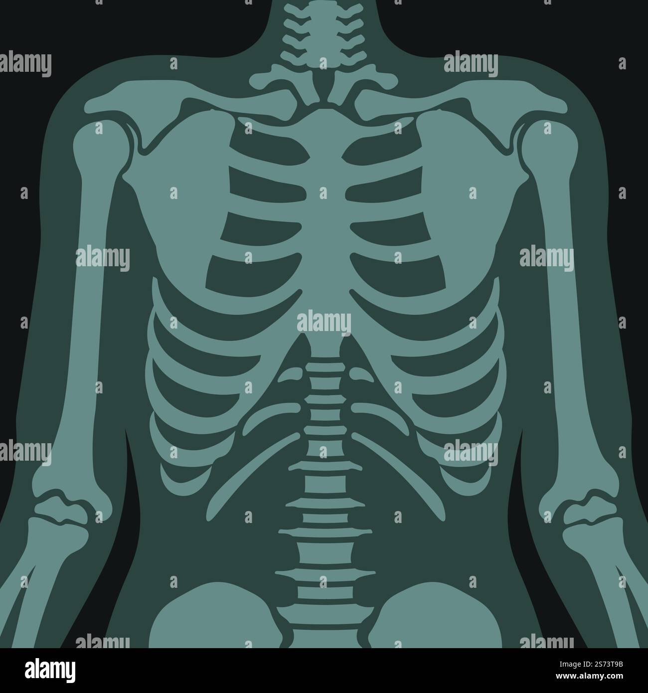 Torace roentgen, scansione a raggi X di paziente con malattie respiratorie. Ospedale e cliniche assistenza sanitaria e trattamento delle malattie, diagnostica e analisi dei risultati. Immagine vettoriale in stile piatto. Raggi X di polmoni e costole, vettore di scansione sanitaria Illustrazione Vettoriale