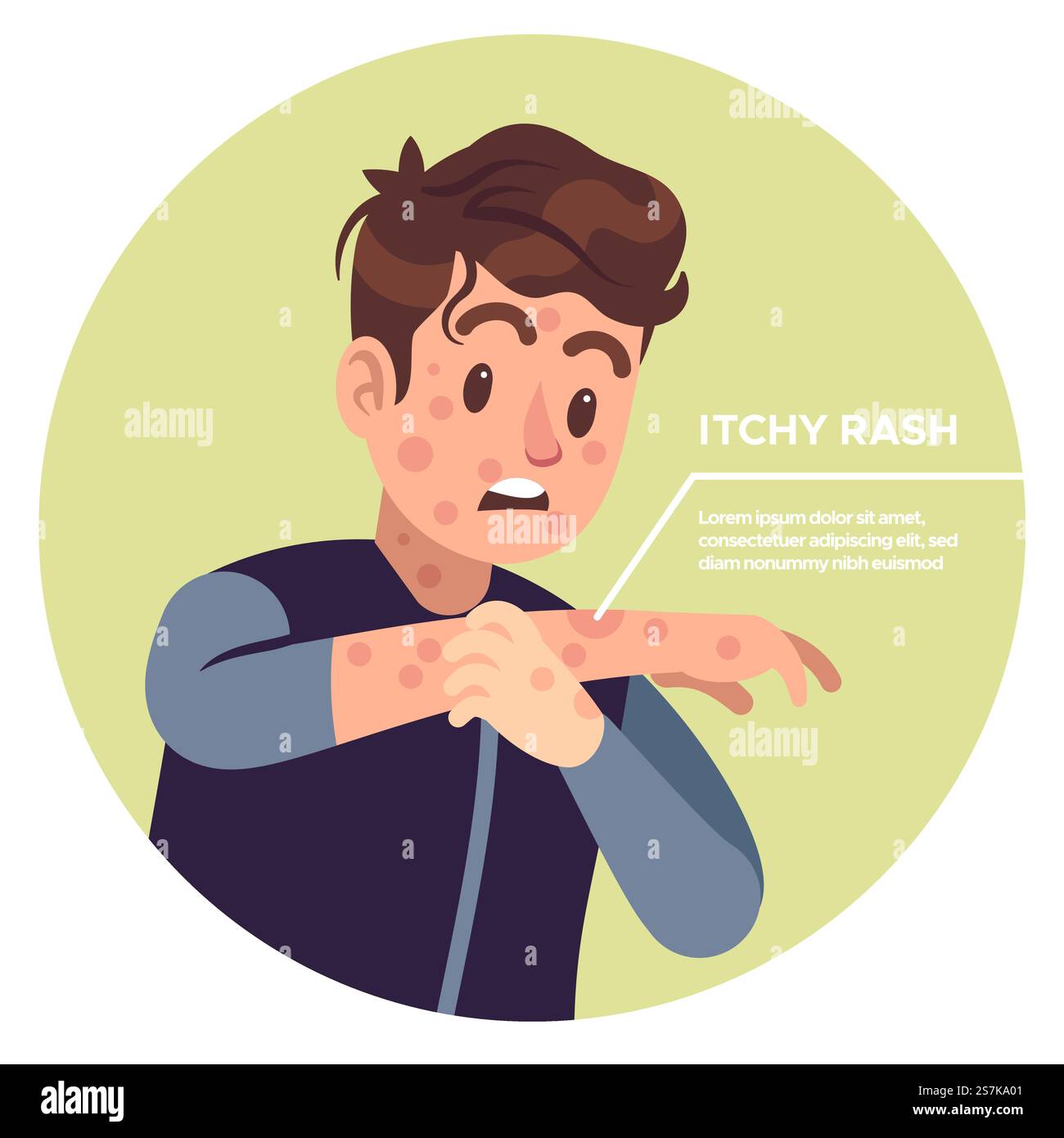 Uomo che gratta le braccia. Infiammazione allergica, irritazione prurito, eczema graffiato, allergia pelle forte dolore salute eruzioni cutanee concetto vettore. Uomo che gratta le braccia. Infiammazione allergica, irritazione prurito, eczema graffiato, allergia pelle forte dolore problemi di salute concetto vettore Illustrazione Vettoriale