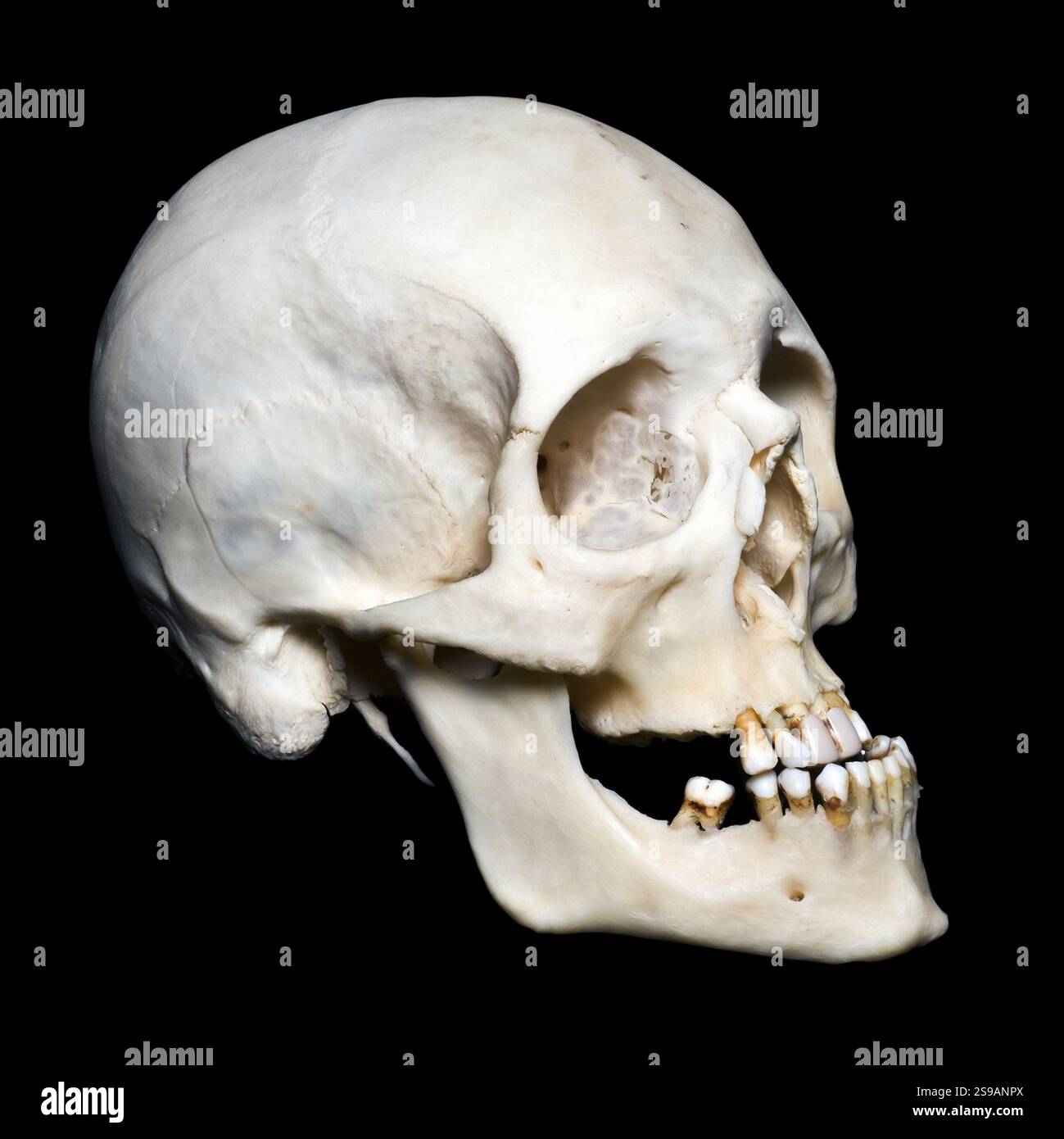 Cranio umano con sfondo nero, ST. Pietroburgo, Russia, Europa Foto Stock