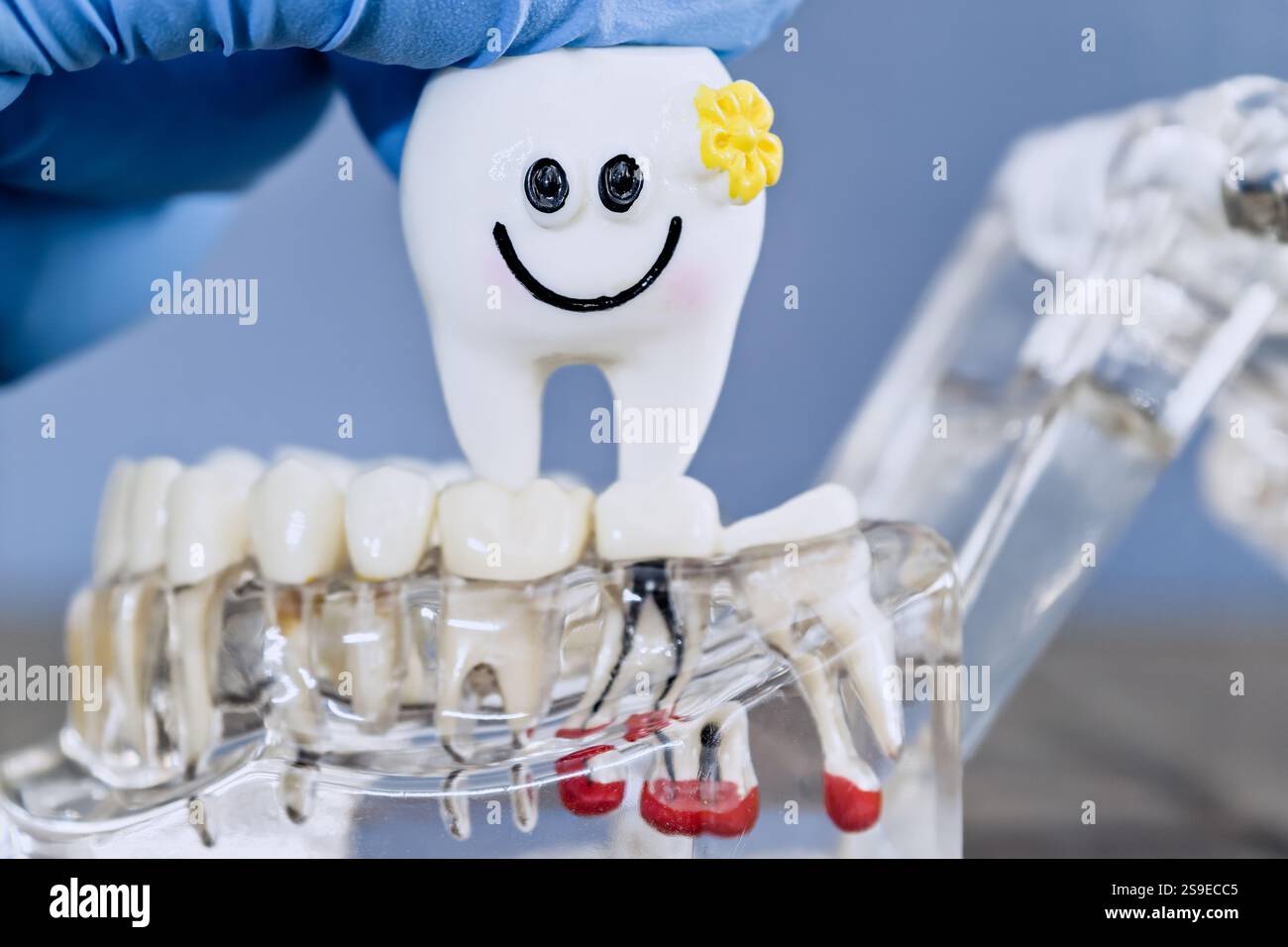 Modello di impianto dentale giocoso con un dente sorridente e un guanto Foto Stock