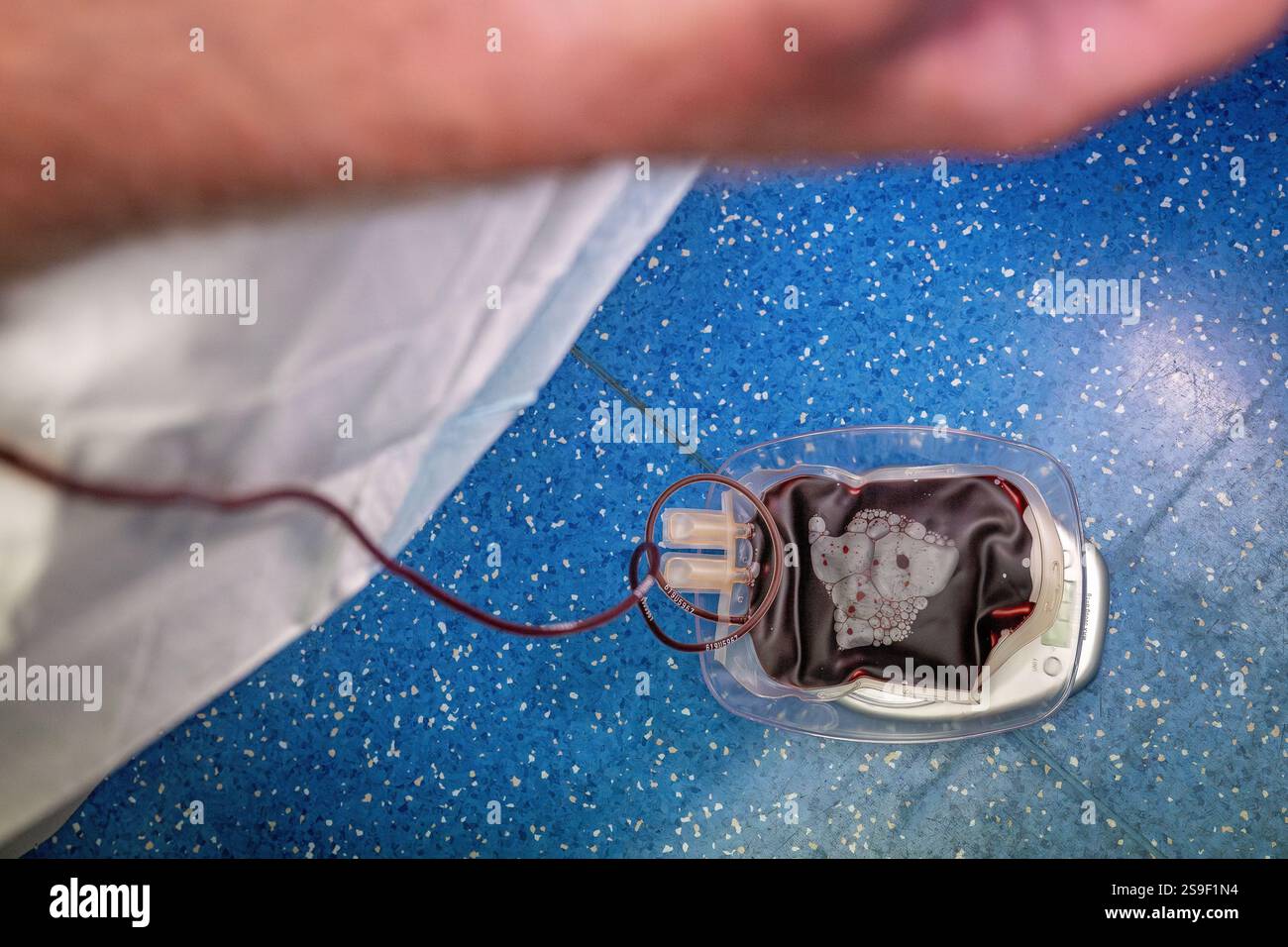 Venesection donazione di sangue, pratica generale australiana clinica GP, sacchetto di raccolta e tubi, assistenza medica Foto Stock