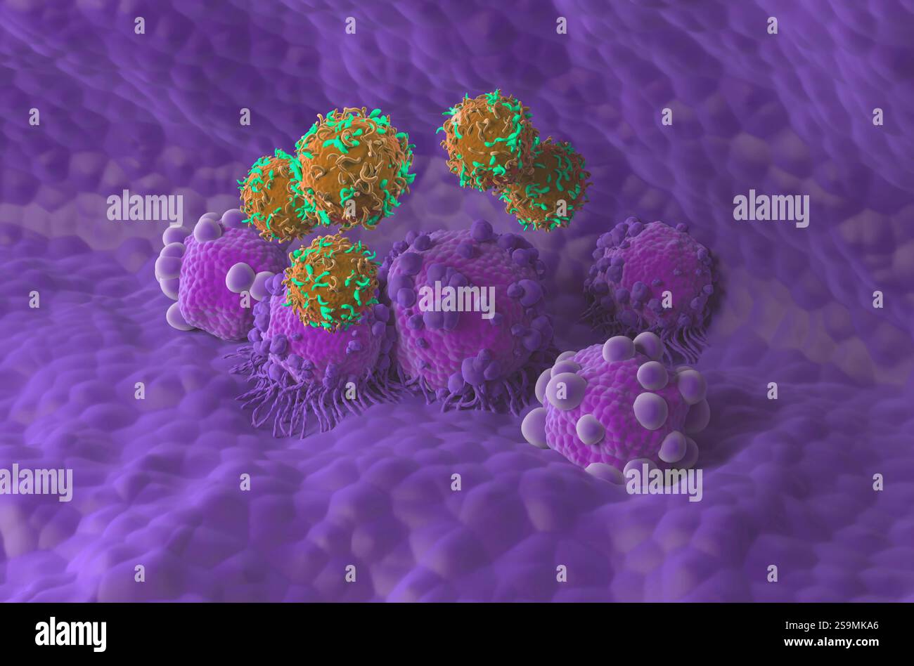 Terapia con cellule T di CAR nel cancro del pancreas - Vista isometrica illustrazione 3d. Foto Stock