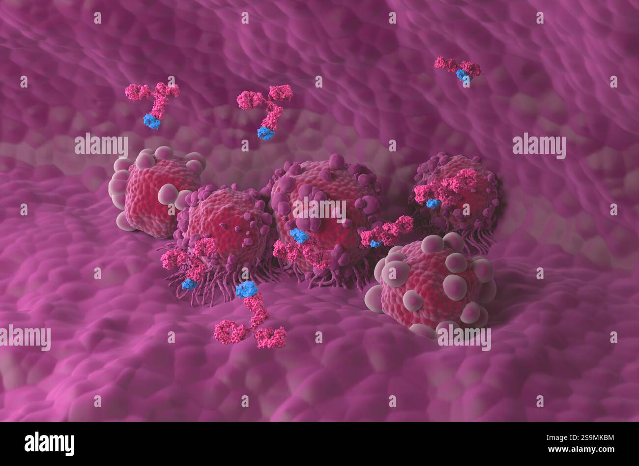 Trattamento con anticorpi monoclonali nel cancro del pancreas - Vista isometrica illustrazione 3D. Foto Stock