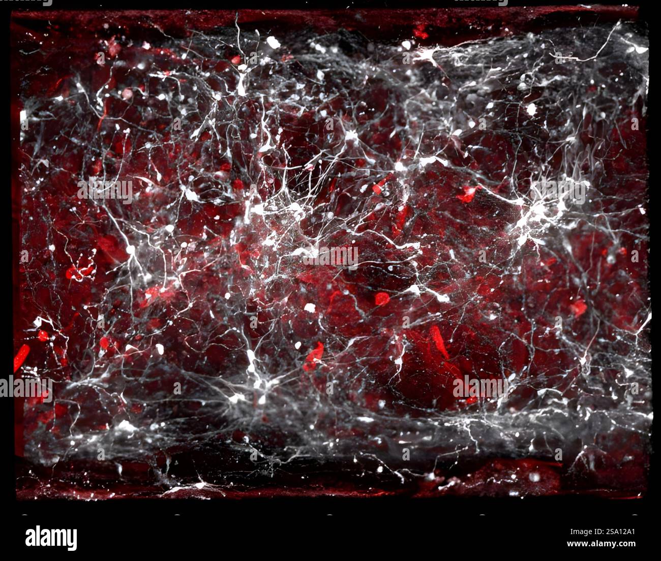 Cellule vascolari e neuroni che producono dopamina del cervello umano. Foto Stock