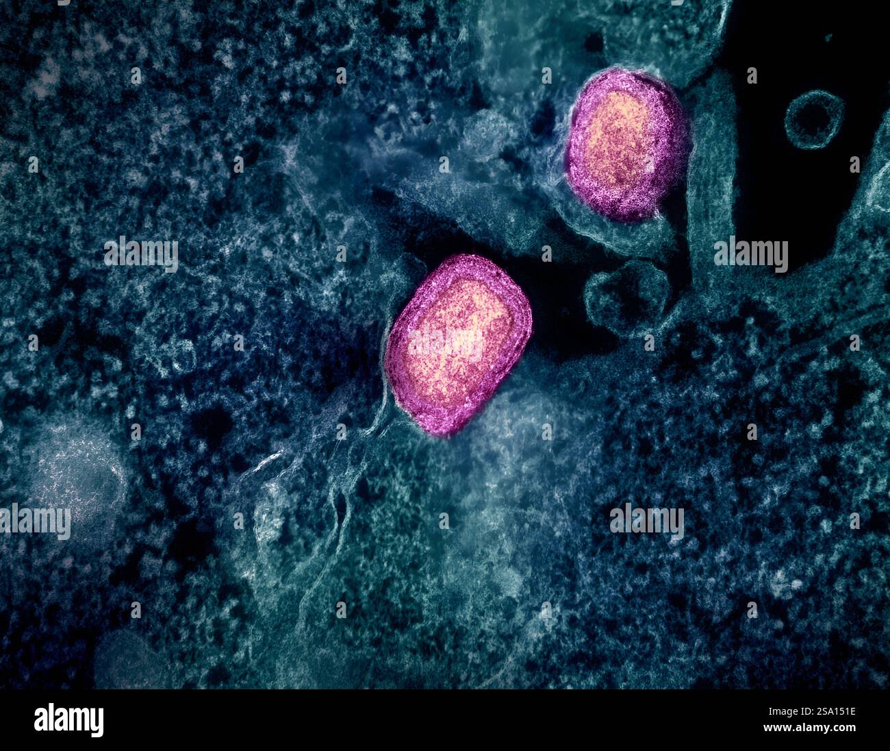 Micrografia elettronica a trasmissione colorata di due particelle di virus mpox maturo (rosa) attaccate alla superficie di una cellula VERA E6 infetta (blu/tè). Foto Stock