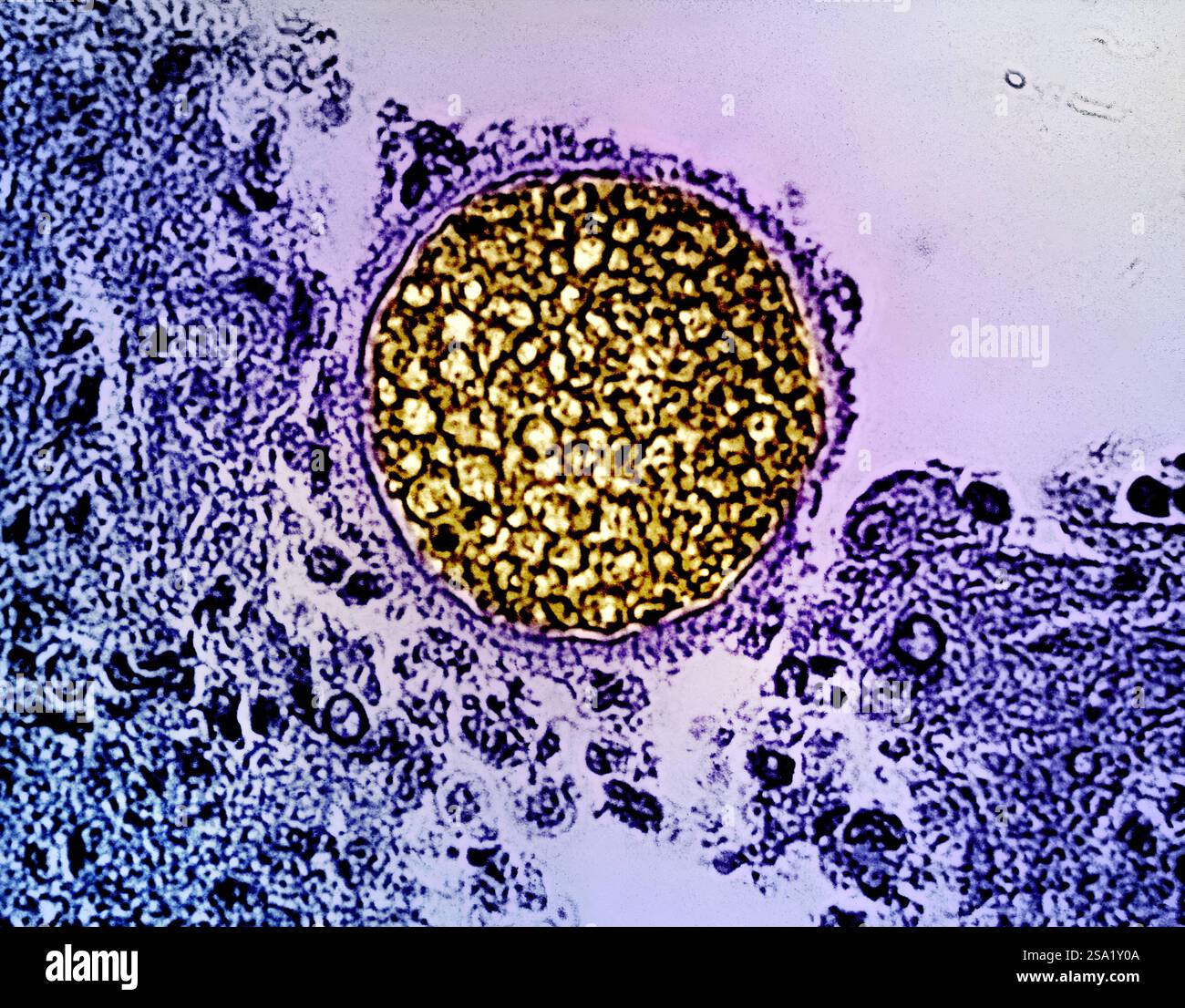 Una sfera micotica di Coccidioides gialla trovata in un campione di tessuto. Questo organismo provoca la coccidioidomicosi, nota anche come febbre della valle. Credito: Micrografo di CDC colorizzazione ed effetti visivi di NIAID Vedi correlati 20 settembre 2024 NIAID Now articolo, &quotazione settimana di sensibilizzazione della malattia di Fungal combattere funghi al NIAID,&quot at. Febbre della valle/Coccidioides fungine sferule 016931 043 Foto Stock