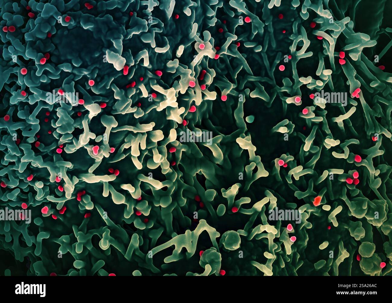 Micrografia elettronica a scansione colorata del virus mpox rosso sulla superficie delle cellule di VERO E6 infette verde. Immagine acquisita presso il NIAID Integrated Research Facility IRF di Fort Detrick, Maryland. Credito: NIAID/NIH. Virus Monkeypox 016931_026 Foto Stock