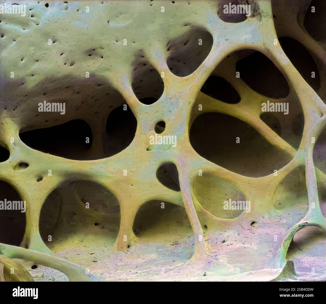 Tessuto osseo degli uccelli. Micrografia elettronica a scansione colorata (SEM) di osso cancelloso (spugnoso) dal cranio di starling (Sturnus vulgaris). Questo tessuto, che si trova all'interno delle ossa, è caratterizzato da una disposizione a nido d'ape di trabecole (colonne) e spazi. Questa struttura a nido d'ape fornisce supporto e resistenza all'osso. Ingrandimento: X25 quando stampato largo 10 centimetri. Foto Stock