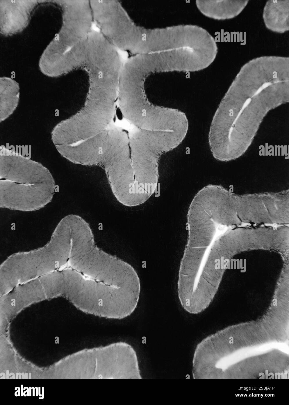 Fiocco di neve sotto forma di dendrite esagonale ordinaria. L'immagine è stata ottenuta utilizzando un microscopio elettronico a scansione a bassa temperatura (LT-SEM). Foto Stock