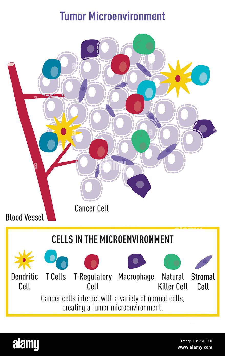 Infografica che mostra come le cellule tumorali interagiscono con una varietà di cellule normali. Foto Stock