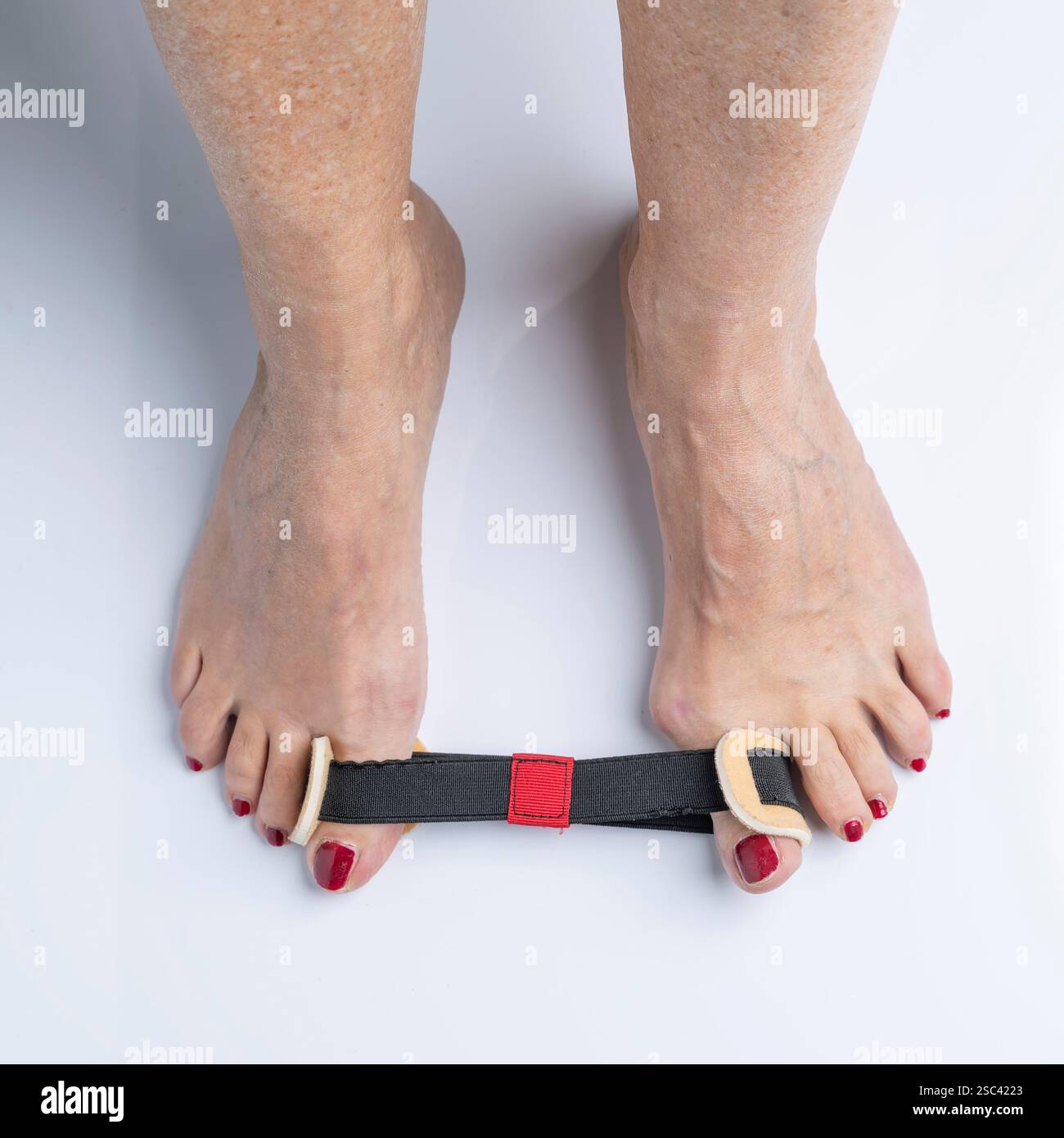 Separatore elastico per correggere l'allux valgus o il bunion Foto Stock