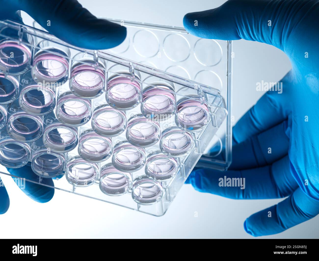 Biomedicina, scienziato che prepara le cellule nel mezzo di crescita in laboratorio Foto Stock