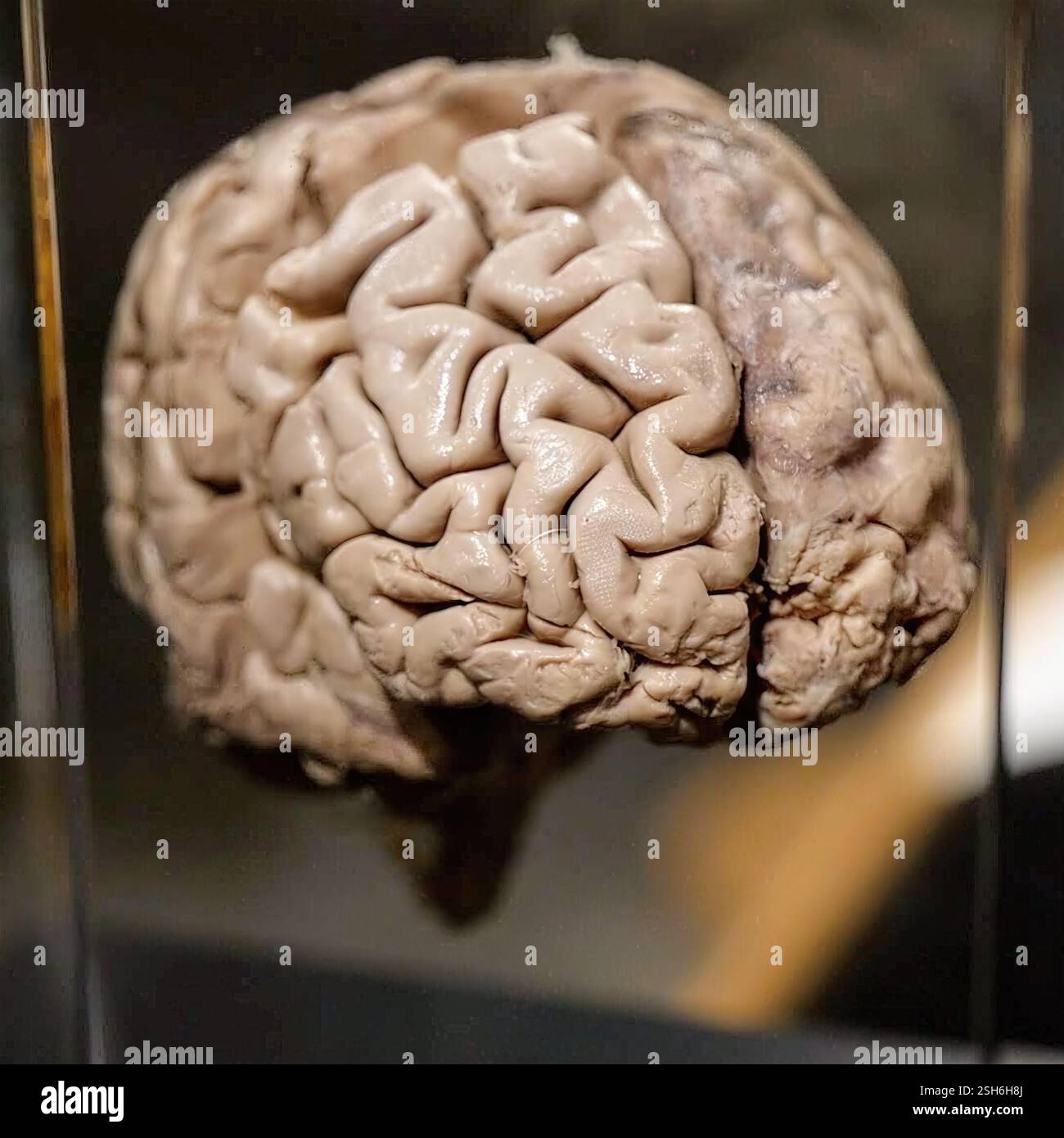 Human Brain Exhibit: Un cervello umano conservato e esposto in una vetrina, che mostra pieghe e texture cerebrali intricate. Foto Stock