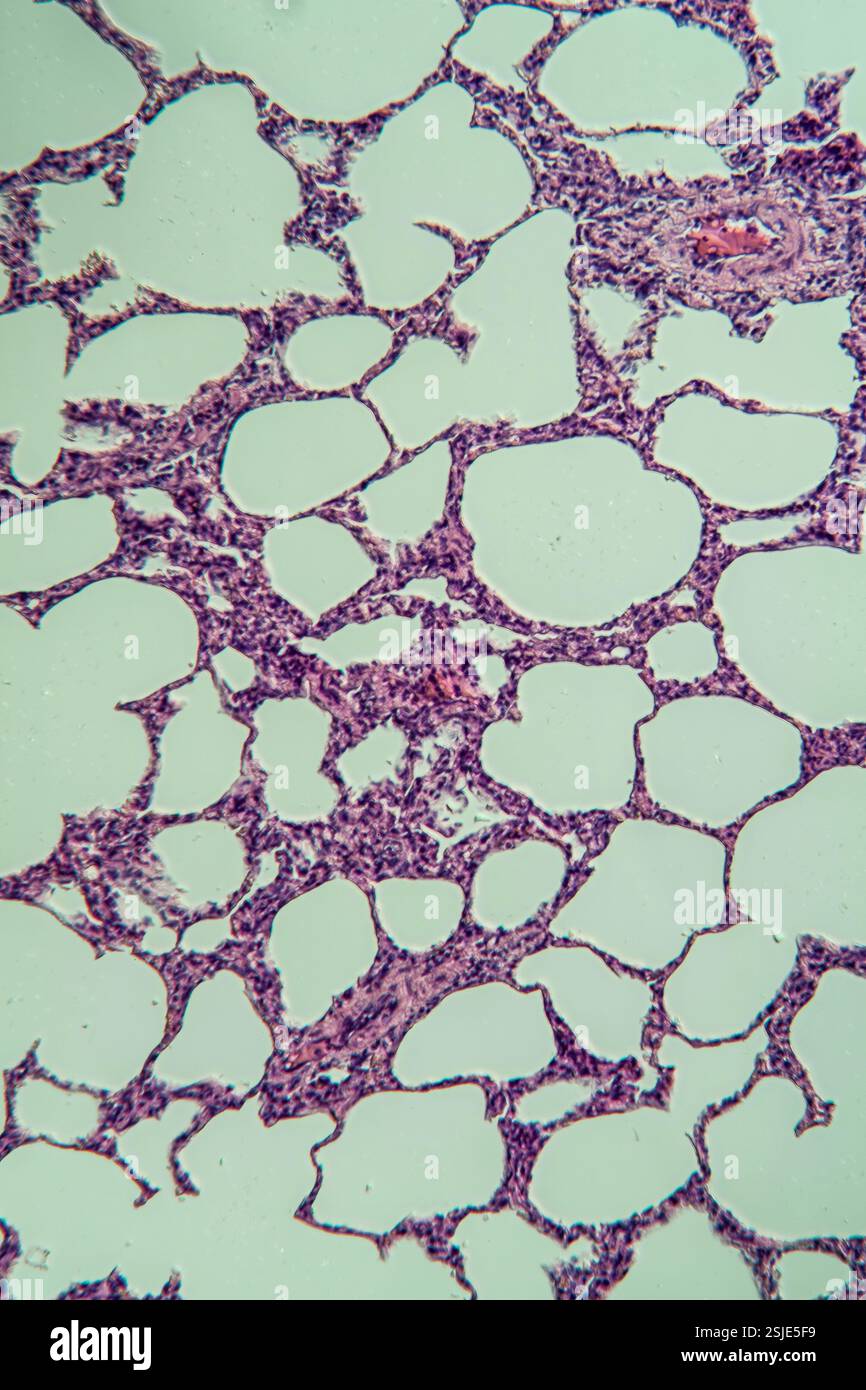 Polmoni al microscopio 100x Foto Stock