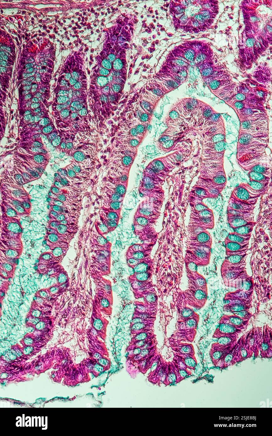 Il piccolo intestino con villi intestinali sotto il microscopio 200x Foto Stock Il piccolo intestino con villi intestinali sotto il microscopio 200x Foto Stock