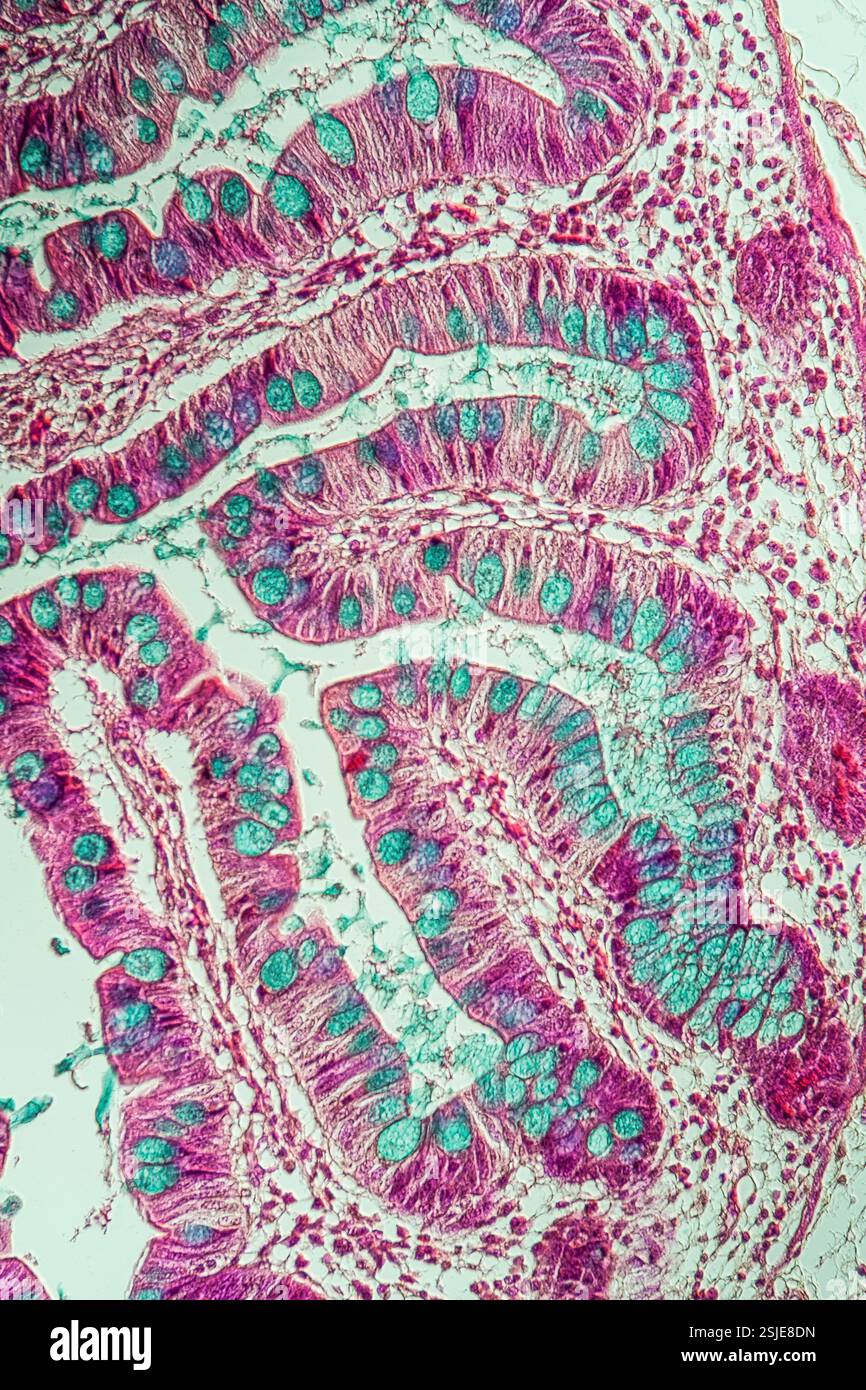 Il piccolo intestino con villi intestinali sotto il microscopio 200x Foto Stock Il piccolo intestino con villi intestinali sotto il microscopio 200x Foto Stock