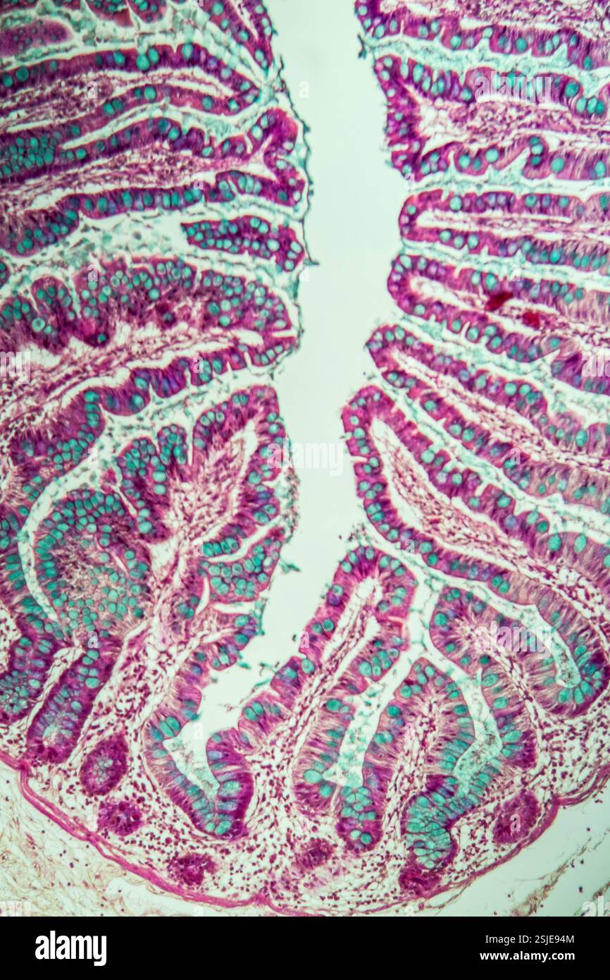 Il piccolo intestino con villi intestinali sotto il microscopio 100x Foto Stock Il piccolo intestino con villi intestinali sotto il microscopio 100x Foto Stock