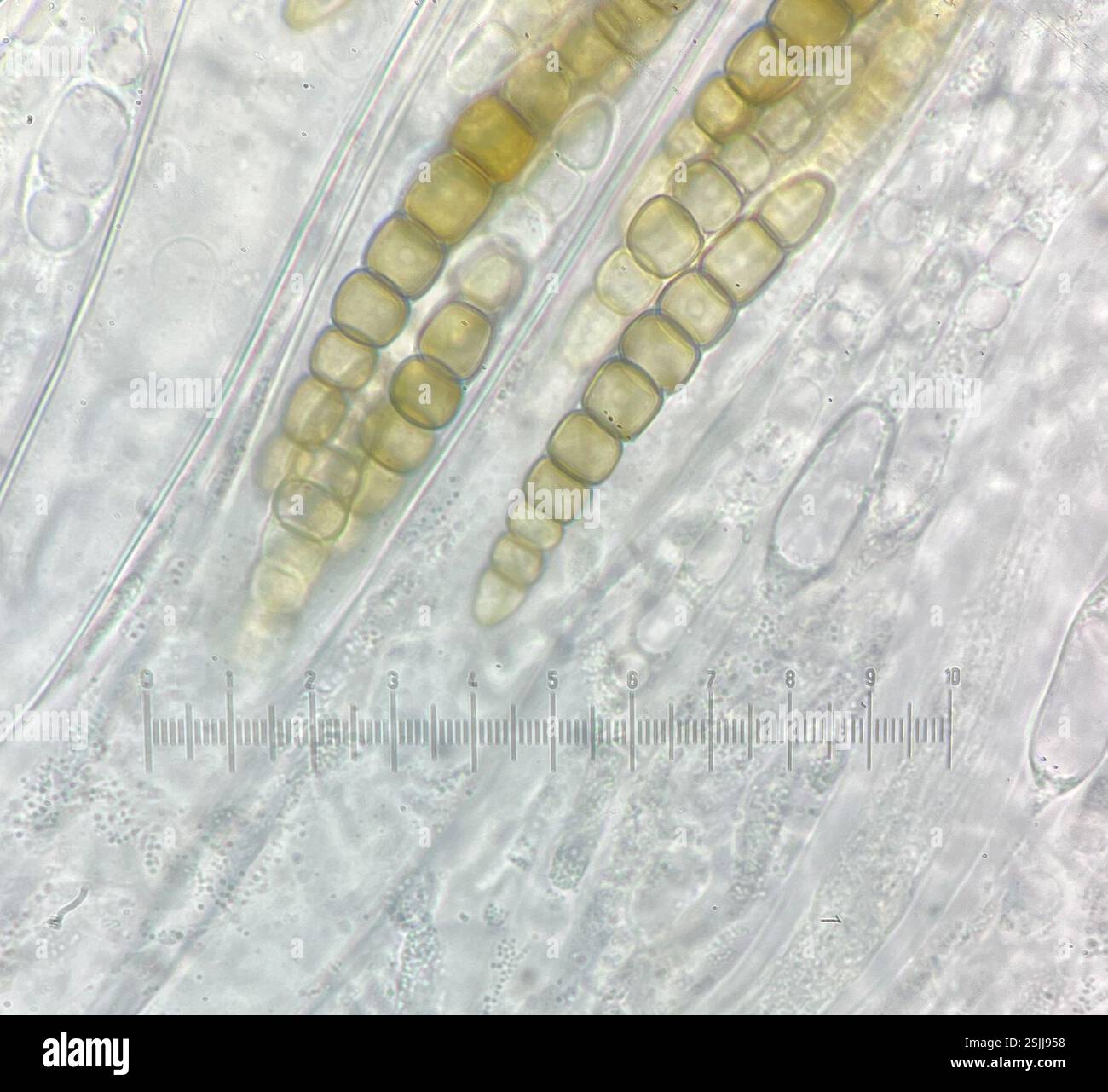 (Sporormiella tela), funghi, Bronx, NY, Stati Uniti, spore 73-86μm x und 8,5-11,5μm. Corpi fruttiferi multipli estremamente tomentosi coperti da una trama miceliale nera Pseudothecia fino a 0,6 mm di larghezza. 7-11 cellule cellulari, 8 cellule più comuni, seguite da 9 e 10 cellule, 11 e 7 cellule rare che crescono su sterco di branta canadensis menzionato da Richardson dall'Islanda; nuovo clade non descritto, potenzialmente in Preussia piuttosto che Sporormiella corrisponde a un campione di terreno proveniente dall'altopiano tibetano con 3bp di differenza (4600m di altitudine) e due campioni di suolo estoni per albero filogenetico vedere l'ultima immagine sequenza LSU OR226402 olotipo per Foto Stock